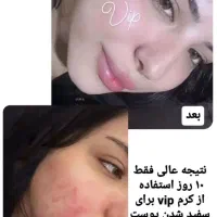 کرم سفید کننده