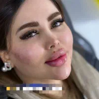 ژل بوتاکس مزو جوانساز فیلر هیپ دیپ بدن مطب پزشک