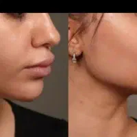 کیلینک دکتر مصطفی یوسفی مقدم زیبایی پوست مو|خدمات آرایشگری و زیبایی|قم, حاج زینل|دیوار