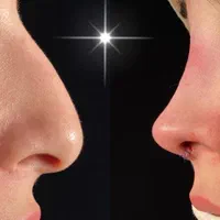 عمل بینی (پیکر تراشی تخصصی) لیپو لیفت پروتز سینه|خدمات آرایشگری و زیبایی|تهران, تهرانپارس غربی|دیوار