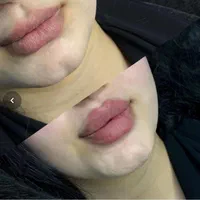 تزریق ژل لب بوتاکس زاویه سازی گونه فول فیس هایفو۲۴|خدمات آرایشگری و زیبایی|مشهد, احمدآباد|دیوار