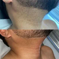 مرکز لیزر و زیبایی (کلینیک ماهلین) دکتر قاسمی