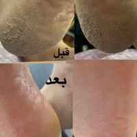 پدیکور پا (اموزش پدیکور) خدمات ناخن ، پاکسازی ، ا|خدمات آرایشگری و زیبایی|بوشهر, |دیوار