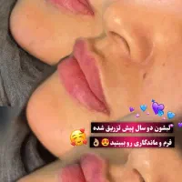 فیلر لب بوتاکس بلفاروپلاستی تخلیه غبغب مزوتراپی|خدمات آرایشگری و زیبایی|اندیشه, اندیشه فاز ۳|دیوار