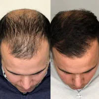 این اقدام اخریشه