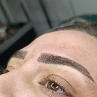 یک نفر مدل فیبروز