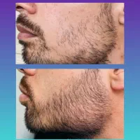 25 روزه|آرایشی، بهداشتی، درمانی|تویسرکان, |دیوار