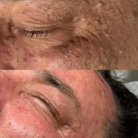 پاکسازی۱۴مرحله اقاوخانم کلینیک پزشک روشنی تضمینی|خدمات آرایشگری و زیبایی|بیرجند, |دیوار