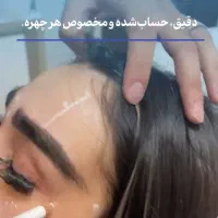 جشنواره بوتاکس|خدمات آرایشگری و زیبایی|اردبیل, |دیوار