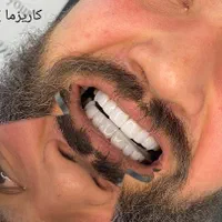 مرکز خدمات کامپوزیت دندان شیراز دندانپزشکی|خدمات آرایشگری و زیبایی|شیراز, قصرالدشت|دیوار