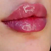 ژل وبوتاکس مواد کرهای اصل