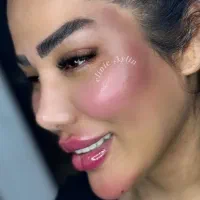 ژل لب فیلر بوتاکس مزو جوانسازی کانتوریگ لیفت نخ