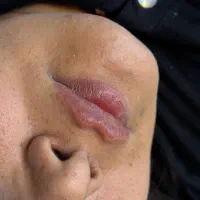 کلینیک تخصصی فیلر و بوتاکس