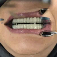 نظافت و تراکت پخش کن