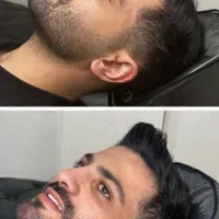 بوتاکس لیفت صورت فیلربادی بلفارو فیلرزاویه سانترال|خدمات آرایشگری و زیبایی|اصفهان, میرعماد|دیوار