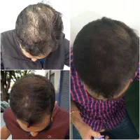 اصولی و درست ترین متد رو براتون انجام میدیم