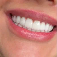 انجام تمامی خدمات دندانپزشکی با اقساط بلند مدت|خدمات آرایشگری و زیبایی|خسروشاه, |دیوار