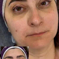جشنواره تخفیف پاکسازی و فیشال، اکستنشن، لیفت|خدمات آرایشگری و زیبایی|تهران, قبا|دیوار