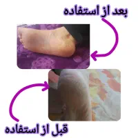 مورفین سلامت و زیبایی پوست|آرایشی، بهداشتی، درمانی|سیب و سوران, |دیوار