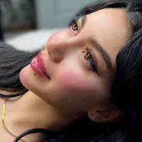 تزریق ژل لب فیلر بوتاکس کانتورینگ آنزیم لیفت صورت