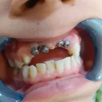 لابراتوار دندانسازی ایمپلنت تخصصی|خدمات آرایشگری و زیبایی|تهران, توحید|دیوار