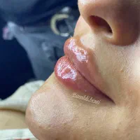 تخفیف ویژه ژل لب، فول فیس اموزش و تمام خدمات