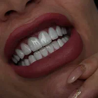 دندانپزشکی تخصصی ایمپلنت،لمینت،روکش دندان،ارتودنسی