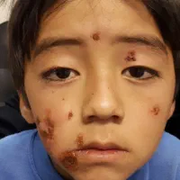 ختنه،جراحی سرپایی شرق|خدمات آرایشگری و زیبایی|دماوند, دماوند|دیوار