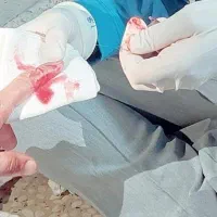 پرستار تزریقات آمپول سرم . پانسمان . سوند. بخیه|خدمات آرایشگری و زیبایی|یاسوج, |دیوار