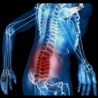 فیزیوتراپی و کاردرمانی در منزل تهران و کرج|خدمات آرایشگری و زیبایی|گرمدره, |دیوار