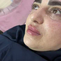 تزریق ژل و بوتاکس فقط۷۵۰|خدمات آرایشگری و زیبایی|هشتگرد, شهرک راه آهن|دیوار