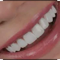 مرکز خدمات کامپوزیت دندان شیراز دندانپزشکی|خدمات آرایشگری و زیبایی|شیراز, قصرالدشت|دیوار