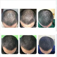 دوست داری موهات دربیاد