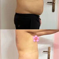 کاهش سایز فوق العاده فقط در ۲ ماه و نیم