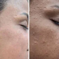 فیشال تخصصی کلینیکی آقایان وبانوان آموزش آقاوخانم|خدمات آرایشگری و زیبایی|بندرعباس, |دیوار