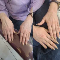 زیبایی ،ژل و بوتاکس وآموزش|خدمات زیبایی و سلامت|تبریز, |دیوار