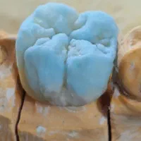 لابراتوار دندانسازی