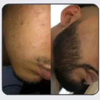 بازی در نیار ریش بزار