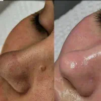 مناسبت افتتاحیه کلینیک زیبای صفا ۵۰ درصد