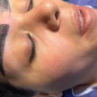 مرکز تخصصی پوست و مو بلفاروپلاستی|خدمات آرایشگری و زیبایی|تهران, جردن|دیوار