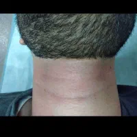 لیزرموهای زائد هنوزباقیمت قبل توعکسهارضایتهاروببین|خدمات آرایشگری و زیبایی|شیراز, ستارخان|دیوار