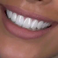 شرایط ویژه جشنواره دندانپزشکی ایمپلنت و اوردنچر|خدمات آرایشگری و زیبایی|آذرشهر, |دیوار