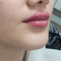 تخفیف تکرارنشدنی|خدمات آرایشگری و زیبایی|رشت, چله خانه|دیوار