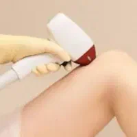 لیزر موهای زائد