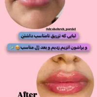 کلینیک زیبایی، تزریقات ژل و بوتاکس و جوانساز