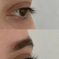 آموزش لیفت فقط با ۲۸۰۰|خدمات آموزشی|بندرعباس, |دیوار