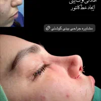 جشنواره عمل بینی