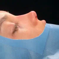آخرین تابستانه و تخفیفات عمل بینی تا آخر شهریور|خدمات آرایشگری و زیبایی|تهران, فلسطین (میدان انقلاب)|دیوار