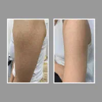 مشاوره تخصصی ماکولار