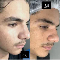 فیشیال صورت آقایان و خانم ها مطب دکترپروین گودرزی|خدمات آرایشگری و زیبایی|یاسوج, |دیوار